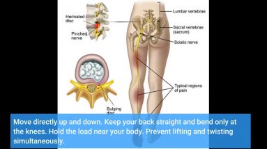 The Facts About Sciatica: Causes, Symptoms, and Treatments - Southern Pain Uncovered