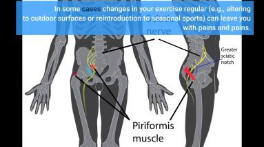 The Facts About Sciatica Information - Sciatic Pain Relief Cushion Revealed