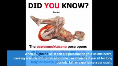 All About Dealing with the Pain of Sciatica