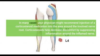 Indicators on Answering Your Questions about Sciatica Pain Treatment You Should Know