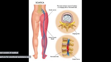 Fascination About Do I Have Sciatica? 10 Of The Most Common Sciatica