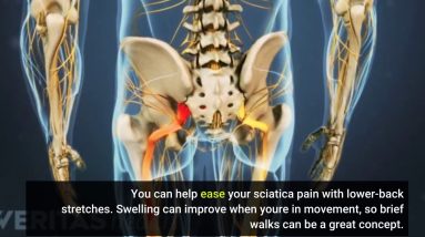 7 Simple Techniques For Sciatica & Pinched Nerve - Symptoms & Treatment - MedStar