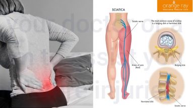 Indicators on When to Consider Sciatica Surgery? You Should Know