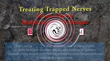 Not known Facts About Diagnosis and treatment of sciatica - NCBI