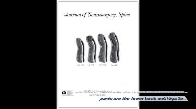 Not known Facts About Spinal Conditions - Sciatica - Medtronic