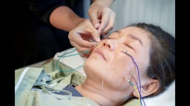 5 Easy Facts About Pinched Nerve Relief at our Richmond, VA Chiropractor Described