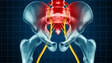 Sciatica - Kaiser Permanente - An Overview