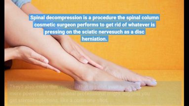 Sciatica - Symptoms and causes - Mayo Clinic Things To Know Before You Buy