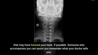 The 10-Minute Rule for How Sciatica Is Treated - Verywell Health