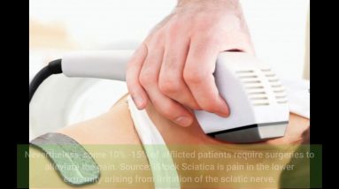 The Definitive Guide to Sciatica - Cedars-Sinai