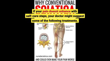 The Pain Treatment for Sciatica - Full Text View - ClinicalTrials.gov PDFs