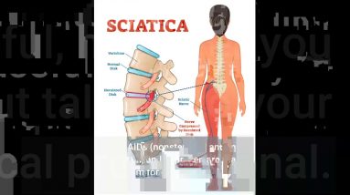 The Ultimate Guide To Sciatica – Penn Medicine