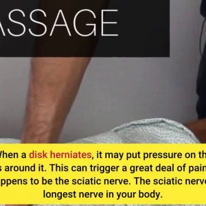 Top Guidelines Of Signs of Sciatica - YouTube