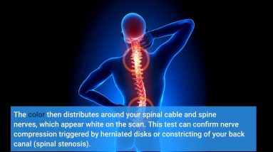 Little Known Questions About Sciatica Pain Treatment in Bradenton, Sarasota, & Venice FL.