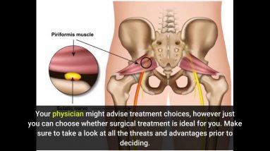 The smart Trick of Spinal Decompression: The Non-Surgical Treatment for That Nobody is Talking...