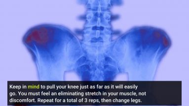 Not known Facts About Sciatica Diagnosis & Treatment - Mount Sinai - New York