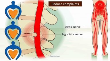 Little Known Questions About The 5 Natural Ways to Relieve Sciatica - StFrancis Sports.