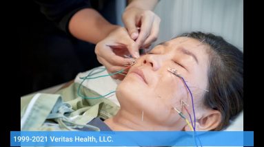 10 Easy Facts About Sciatic Nerve Pain I Radiating Leg Pain Symptoms & Treatment Explained