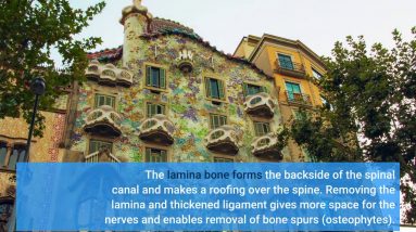 Getting The Minimally Invasive Lumbar Micro-Decompression - San To Work