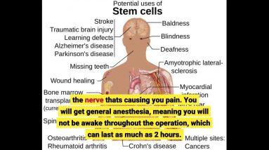The 30-Second Trick For Best Physical Therapy Techniques for Sciatica - Pacific