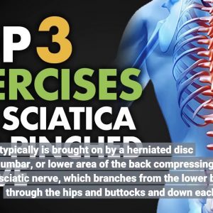 The Of Sciatica Nerve Pain - When to See a Doctor for Sciatica
