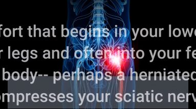 Some Known Facts About Sciatica Treatments and Home Remedies - Everyday Health.